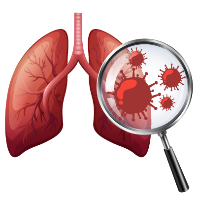 Pneumonia
