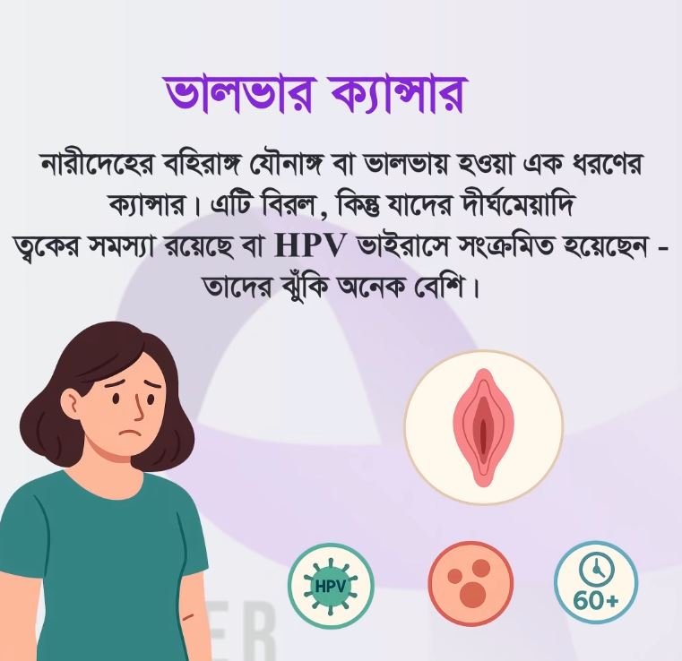 ভালভার ক্যান্সার হল নারীদেহের বহির যৌনাঙ্গ বা ভালভায় হওয়া এক ধরনের ক্যান্সার